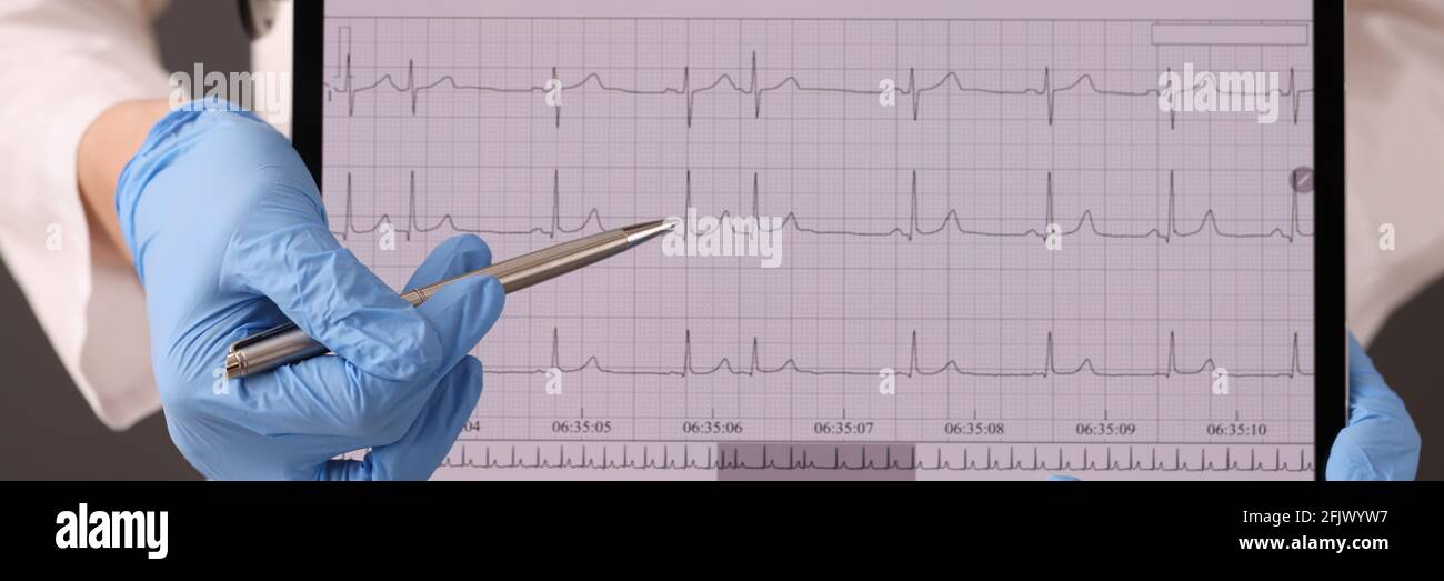 Médecin en gants de caoutchouc tenant un comprimé numérique avec un cardiogramme de gros plan Banque D'Images