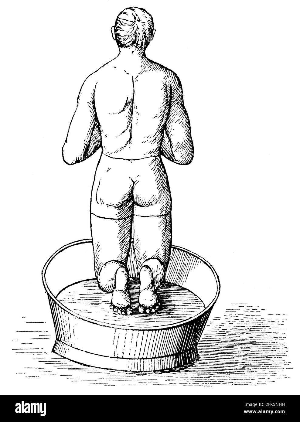 Hydrothérapie du dos du corps. Illustration du 19e siècle. Allemagne. Arrière-plan blanc. Banque D'Images