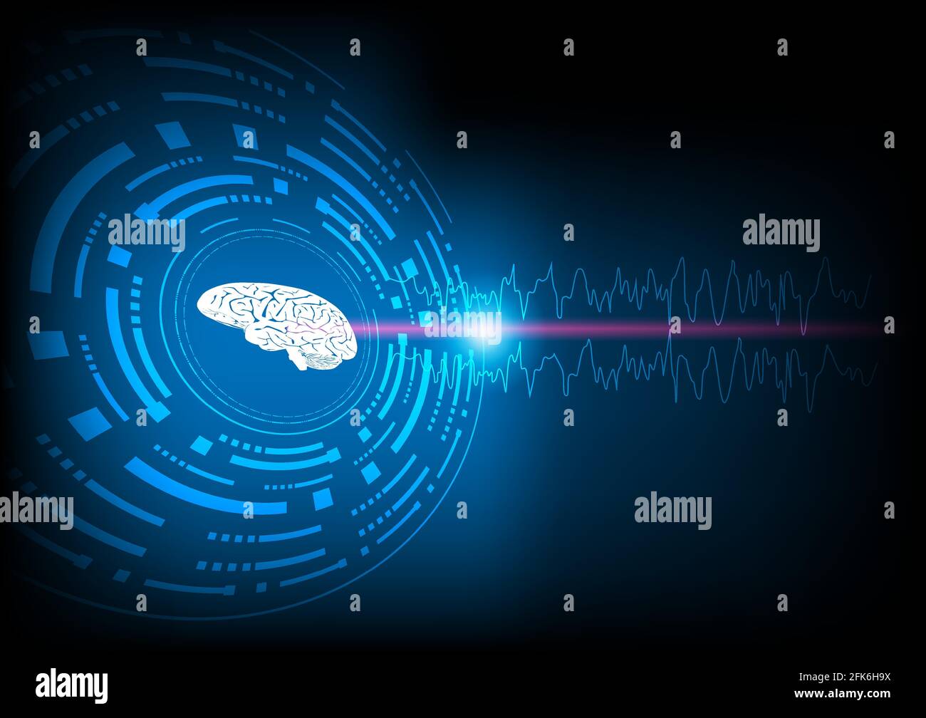 Crise focale. Illustration du cerveau humain et de l'électroencéphalograhie ou EEG provenant d'un début régional. Expérience technologique. Illustration de Vecteur