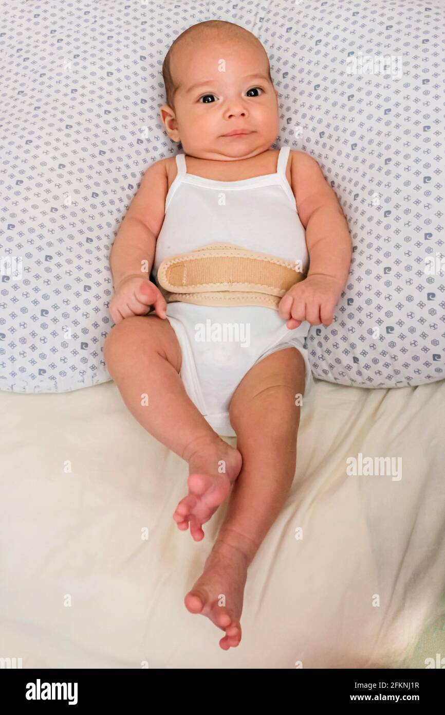 Bébé dans un bandage de hernie ombilicale. Bébé chauve doux sur le lit  Photo Stock - Alamy