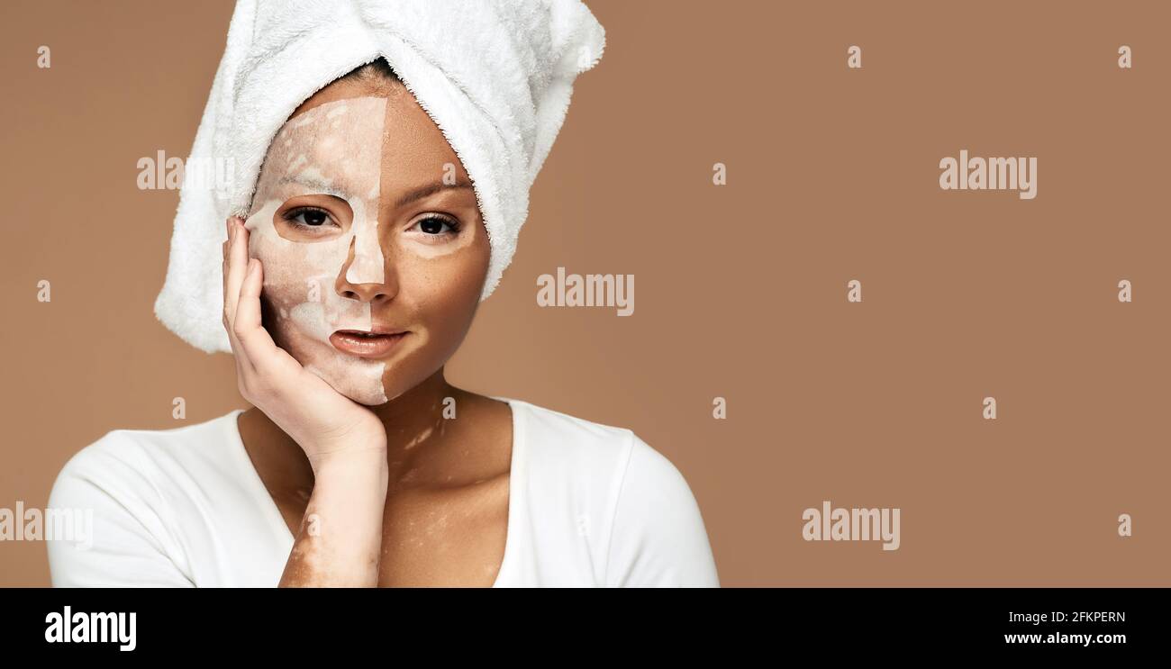 Soins de la peau. Femme avec problème de peau et de vitiligo applique tissu cosmétique masque facial, visage hydratant et hydratant Banque D'Images