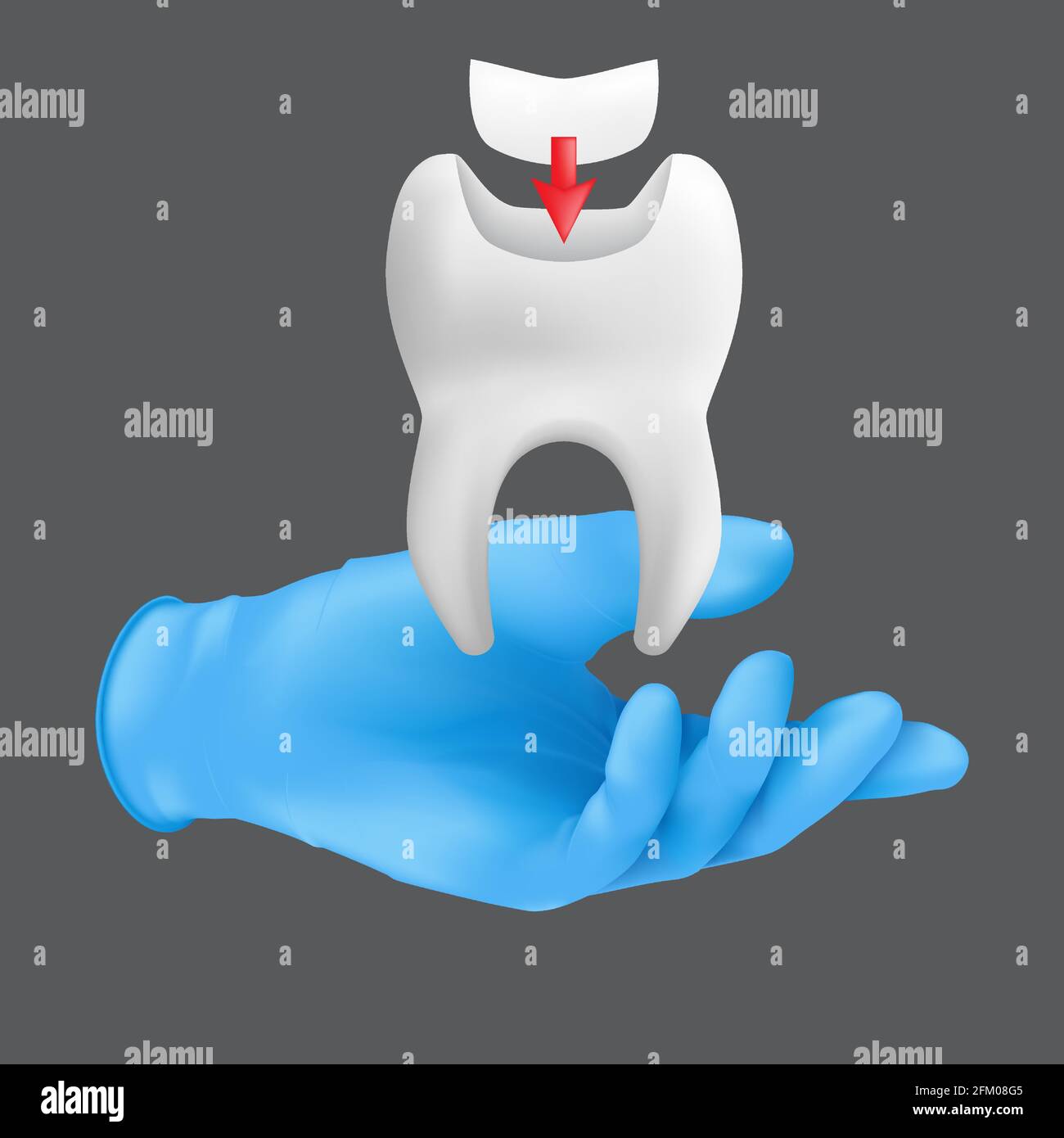 Main de dentiste portant un gant de protection chirurgical bleu tenant un modèle de la dent en céramique. illustration vectorielle 3d réaliste du concept de plombages dentaires Illustration de Vecteur