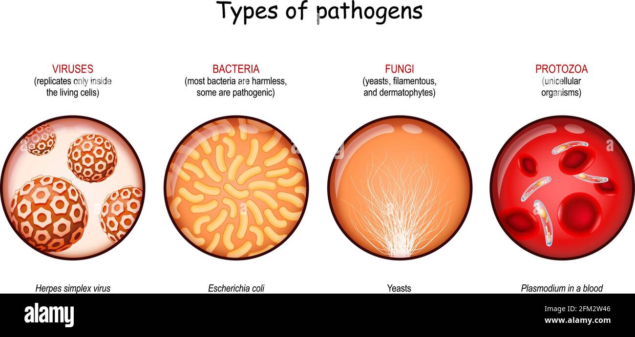 Types d'agents pathogènes : virus, bactéries, champignons et protozoaires. Illustration vectorielle Illustration de Vecteur