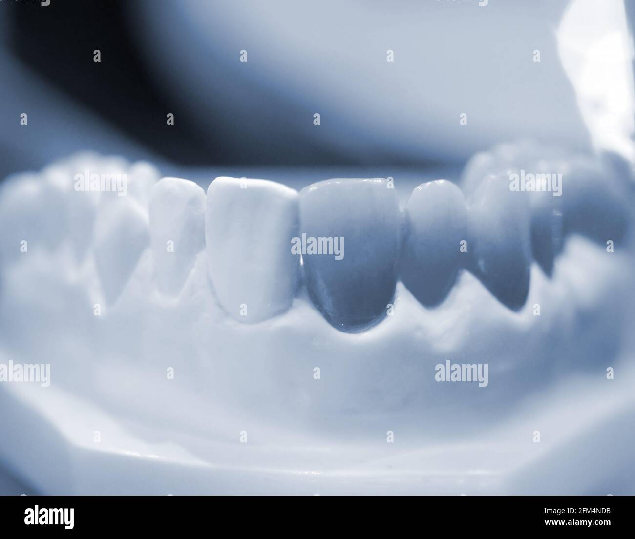 Modèle de dents humaines avec dents artificielles gros plan. Banque D'Images
