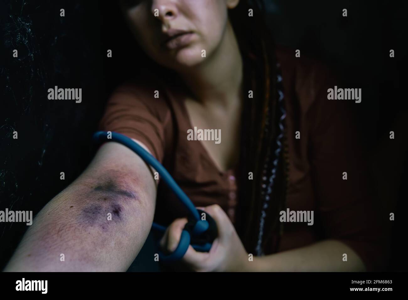 Fille adulte avec des dreadlocks avant de prendre la dose de stupéfiant dans la veine. La femme drogué tire sa main avec le tourniquet. Ponction des plaies et des ecchymoses sur le bras de la femme. Banque D'Images