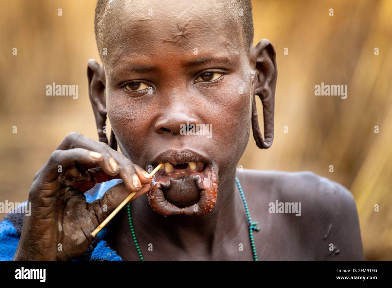 Cette femme de Mursi avait auparavant des plaques à lèvres et des plaques d'oreille. DEBUB OMO ZONE, ETHIOPIE: RENCONTRER LA tribu où les femmes commencent à étirer leurs lèvres W Banque D'Images