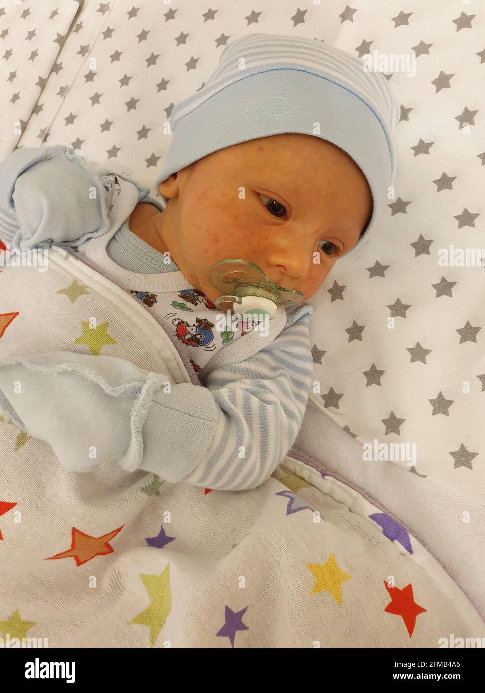 Nouveau Ne Avec Une Eruption Cutanee Portrait De Bebe En Gros Plan Photo Stock Alamy