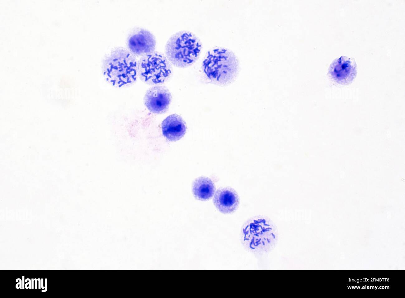 Chromosomes humains, micrographe léger Banque D'Images