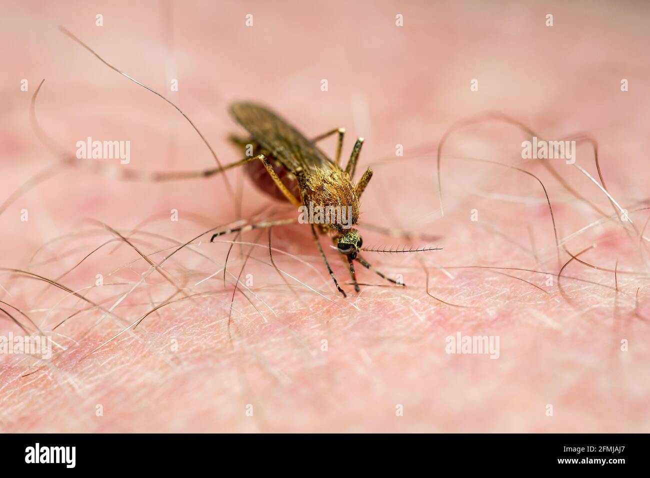 Piqûre de moustique infectée par le virus Zika. Leishmaniose, encéphalite, fièvre jaune, dengue, maladie du paludisme, Mayaro ou virus Zika Culex infectieux Mosquitoe Paras Banque D'Images