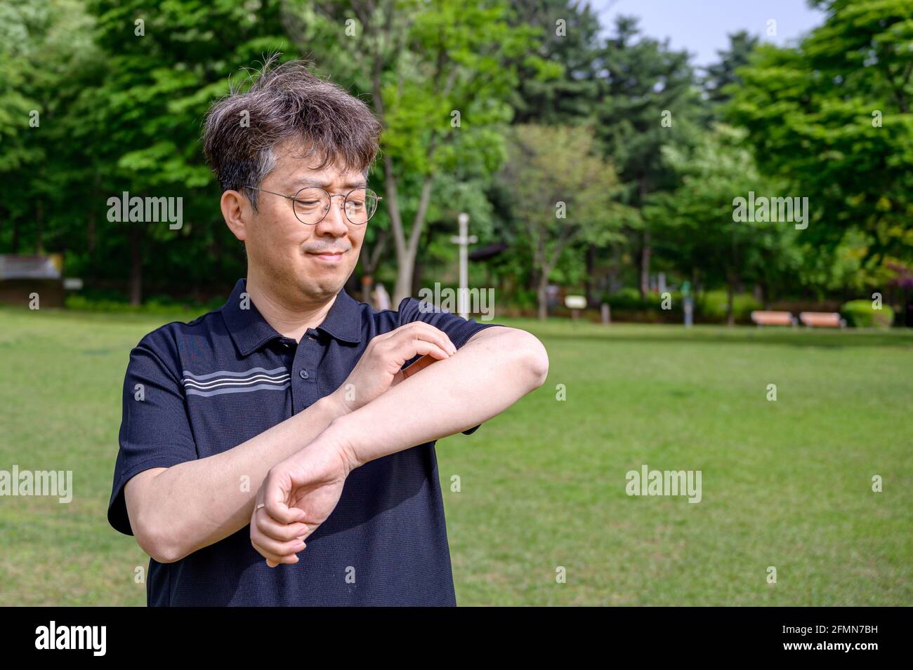 Homme asiatique d'âge moyen se grattant le bras à cause de l'allergie au soleil. Banque D'Images