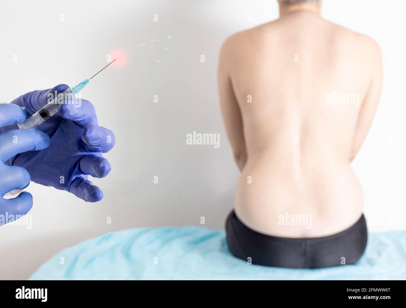 Le médecin tient dans ses mains une seringue avec des médicaments anti-inflammatoires et analgésiques pour les maux de dos. Concept de thérapie par injection de joint Facet, médicinal Banque D'Images