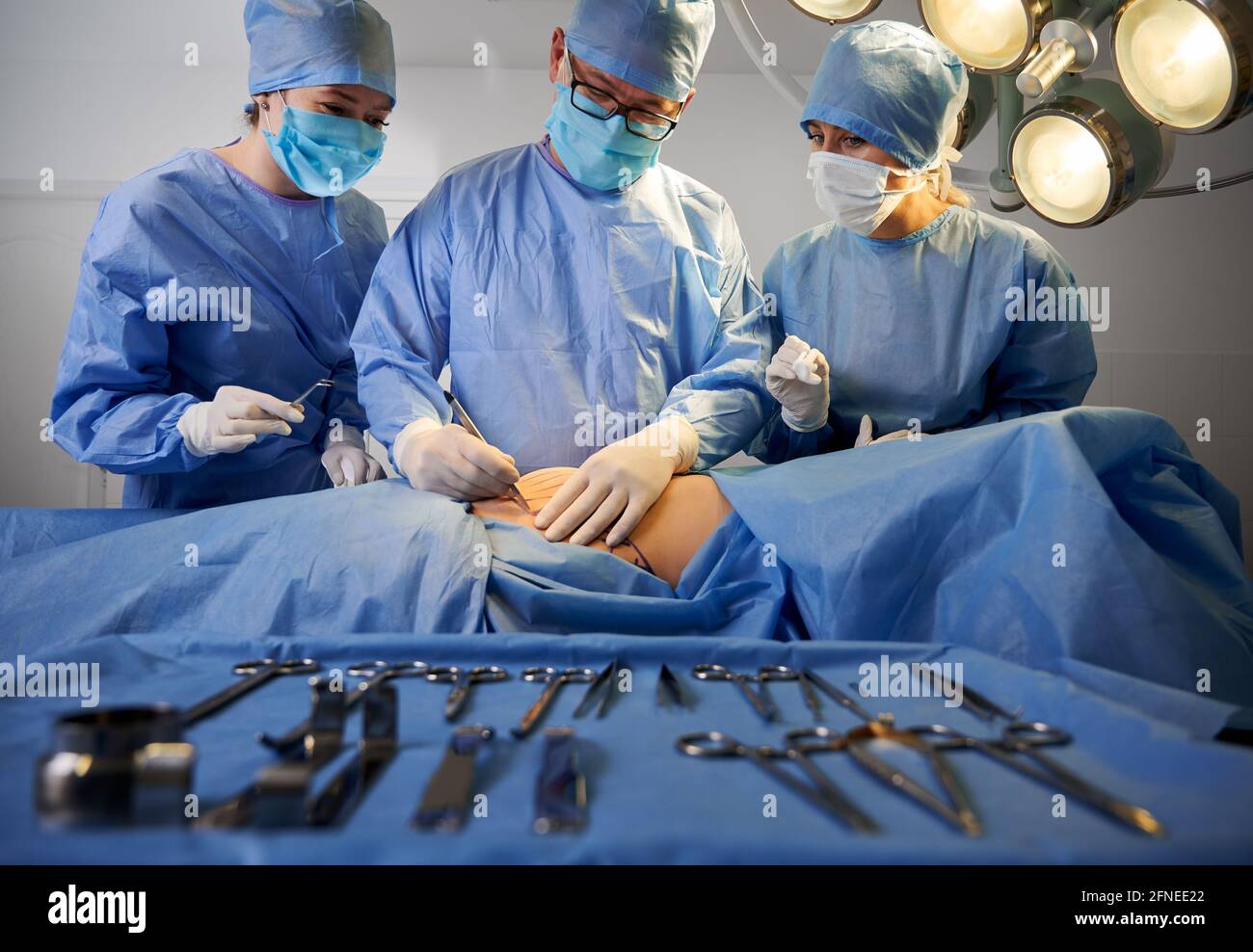 Groupe de médecins portant des gants stériles et des masques protecteurs faisant de la chirurgie plastique en salle d'opération. Équipe chirurgicale effectuant une chirurgie esthétique alors que le patient est allongé sur la table d'opération près des outils médicaux. Banque D'Images