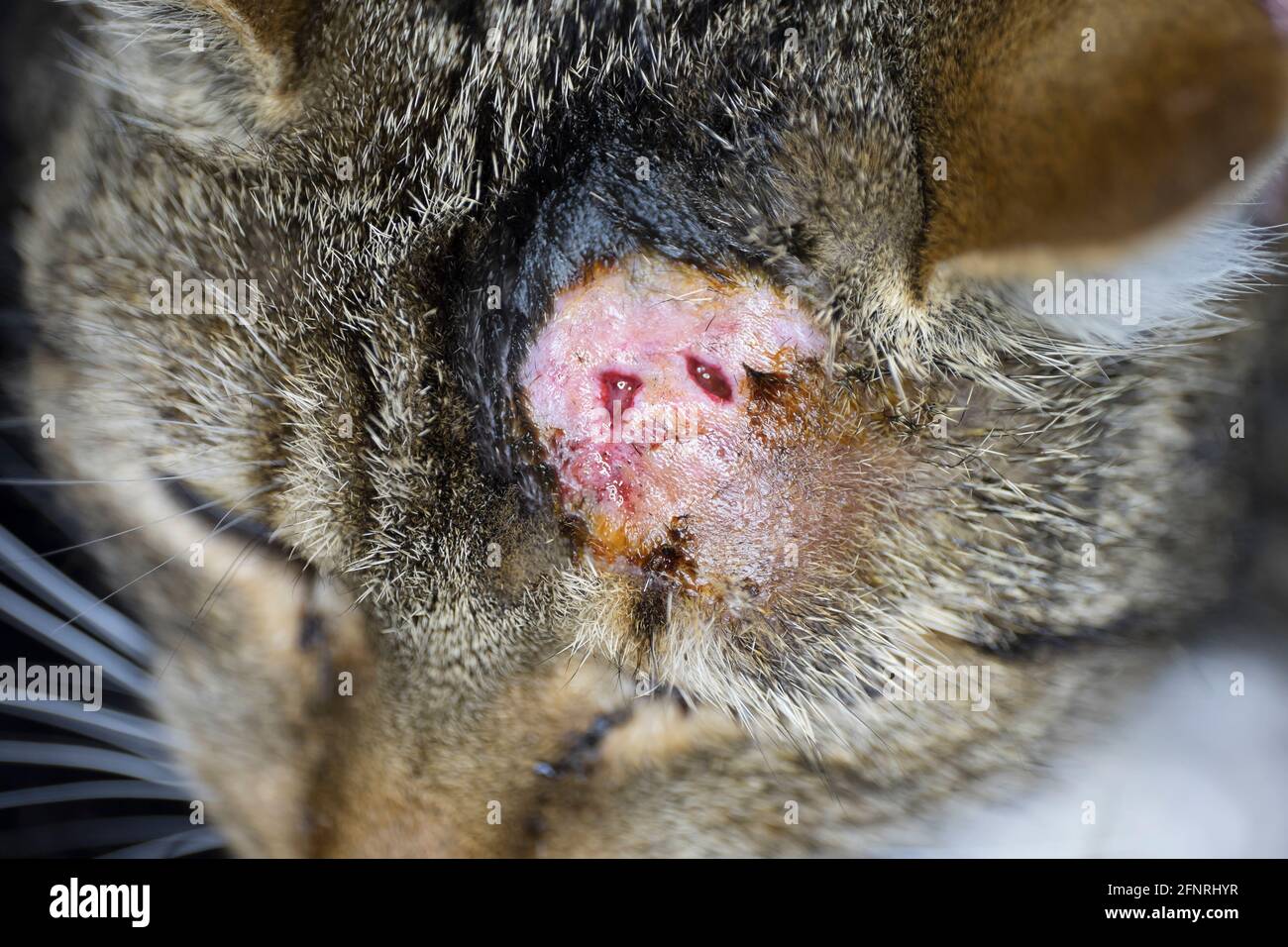 Abces Banque D Image Et Photos Alamy
