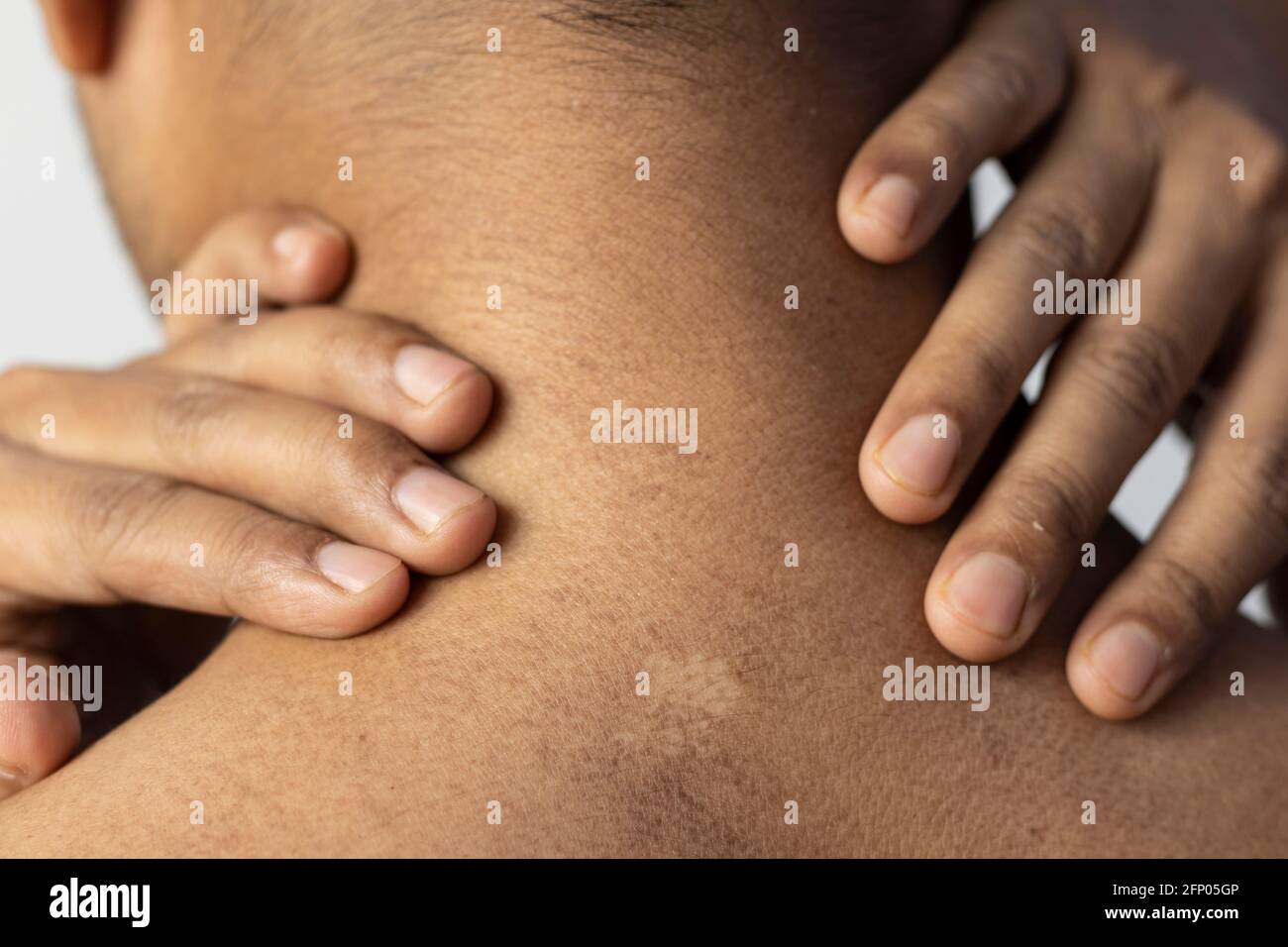 Peau Plus Foncee Banque De Photographies Et D Images A Haute Resolution Alamy