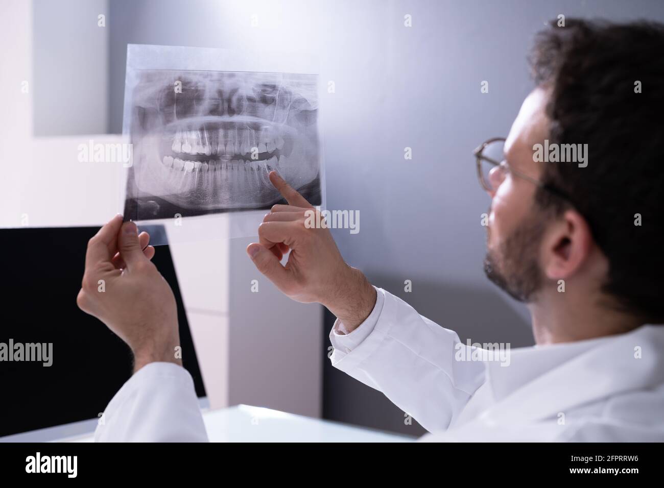 Sagesse dents dentaire X-Ray image. Douleur dentaire Banque D'Images