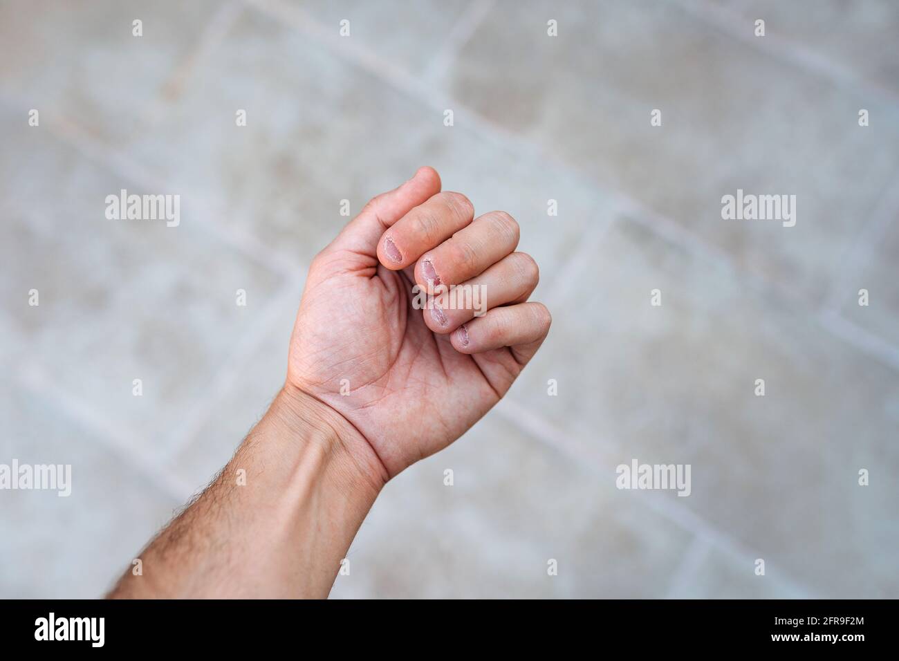 Main d'un homme avec des ongles mordus et laids. Mauvais soin des mains Banque D'Images