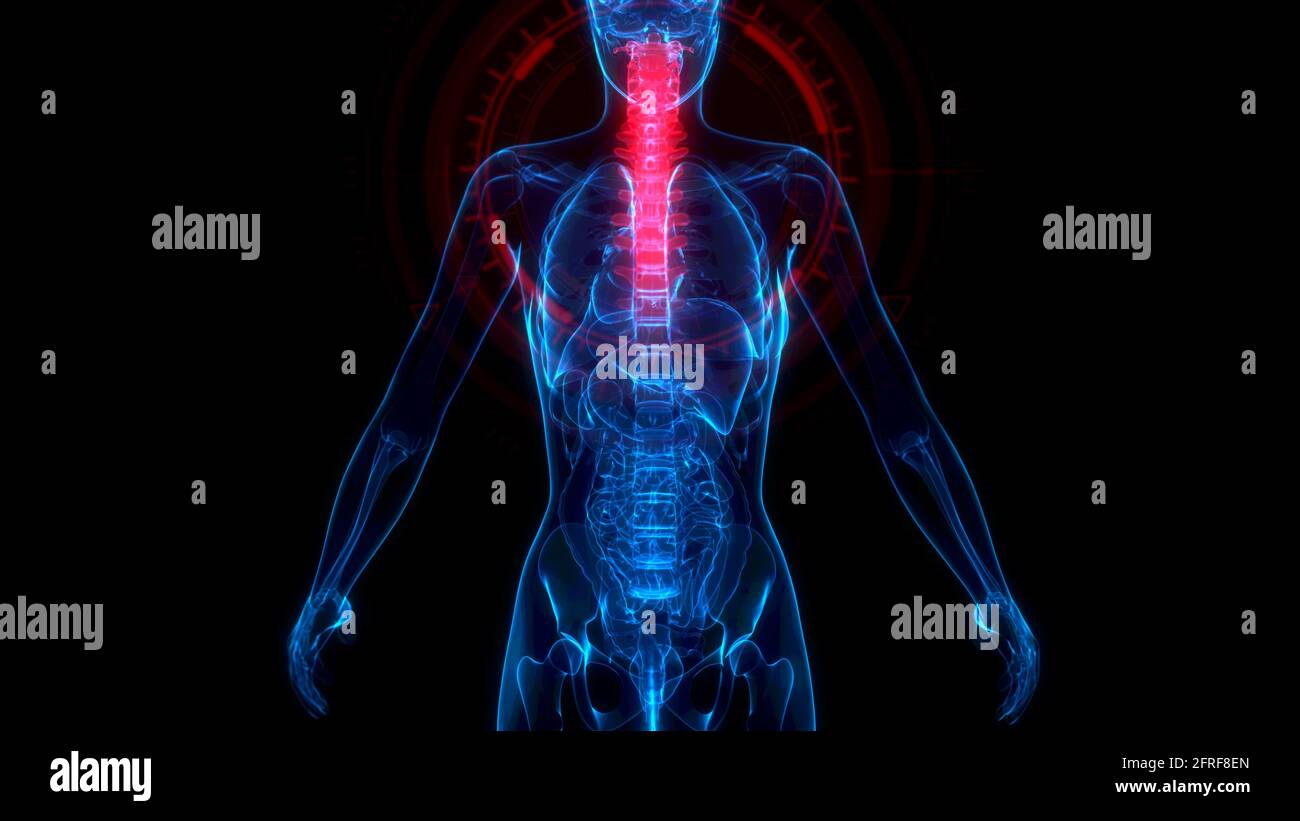 cg médecine 3d illustration, cervical, partie supérieure de la colonne vertébrale humaine sur le corps xray Banque D'Images