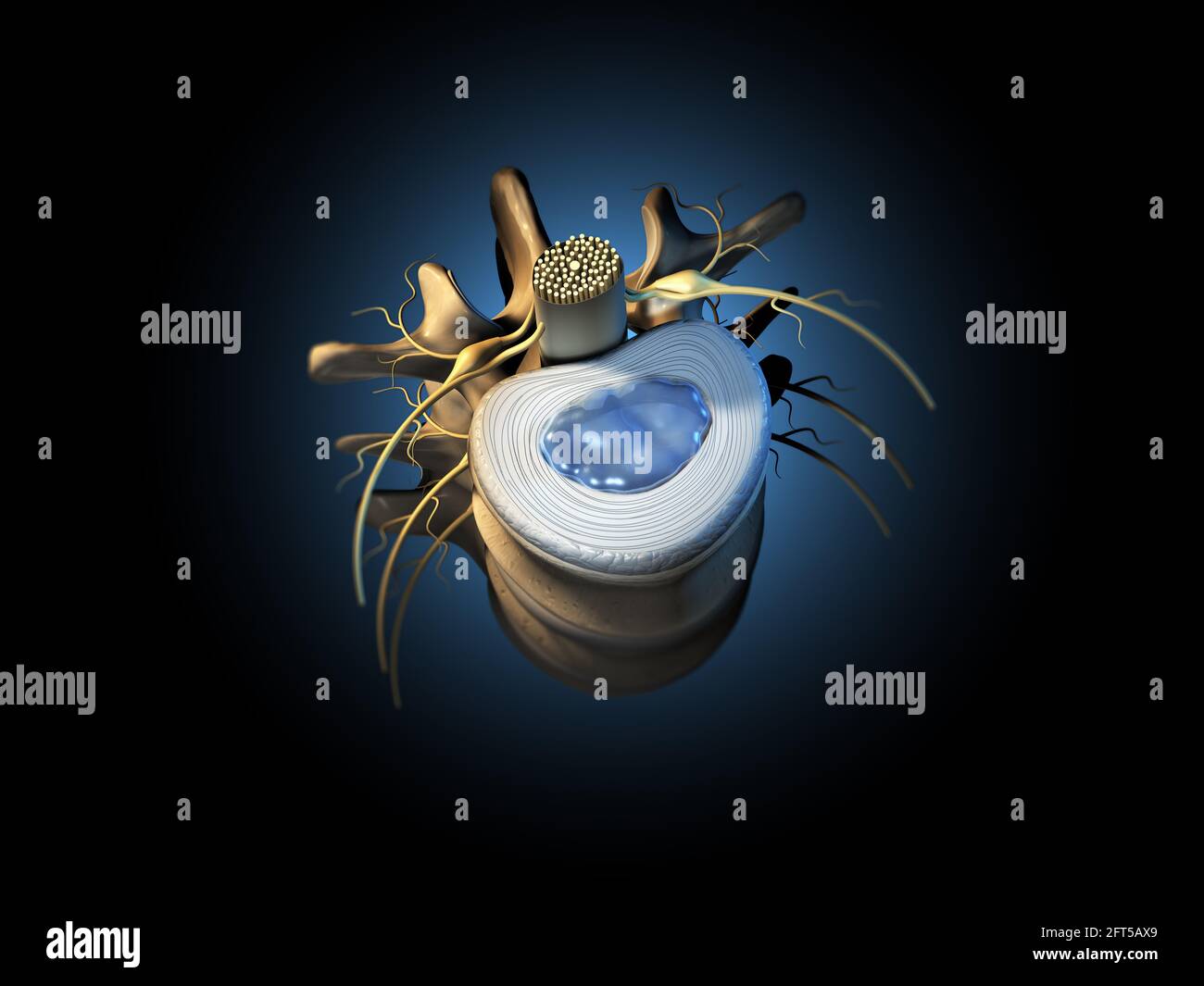 Illustration 3D montrant une vertèbre lombaire avec un disque et un noyau intervertébraux pulposus Banque D'Images