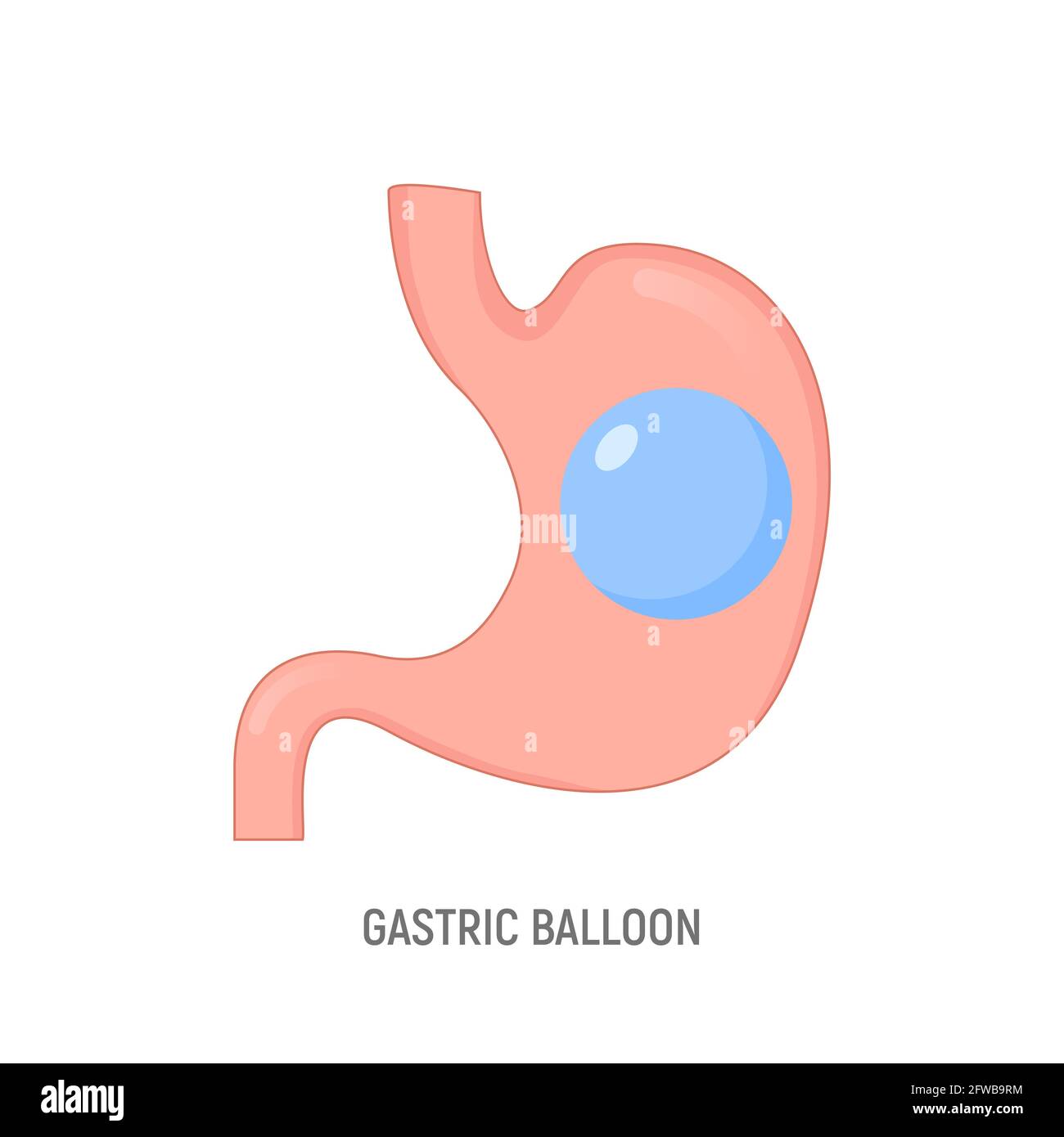 Ballon gastrique perte de poids chirurgie intragastrique. Icône de vecteur  d'opération de ballon gastrique d'estomac Image Vectorielle Stock - Alamy