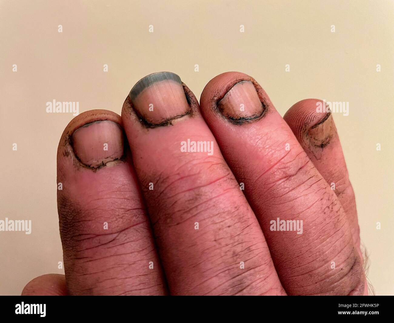 Gros plan des doigts sales d'un homme après avoir travaillé sur un équipement sale avec de la saleté sous ses ongles. Banque D'Images