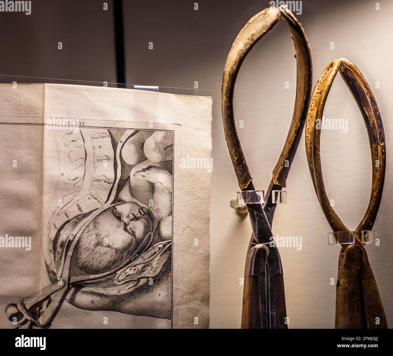 Premiers outils médicaux obstrétiques (forceps en bois) pour la dystocie. Exposition au Rijksmuseum Boerhaave à Leiden, pays-Bas Banque D'Images