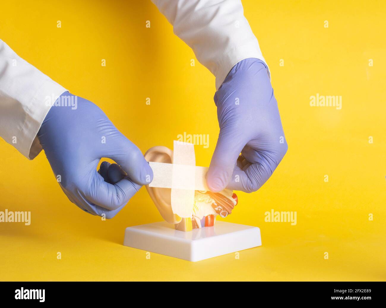 Le médecin colle un plâtre sur une maquette d'oreille humaine sur fond jaune. Traitement de l'audition et de la récupération concept après Covid 19, chronique Banque D'Images