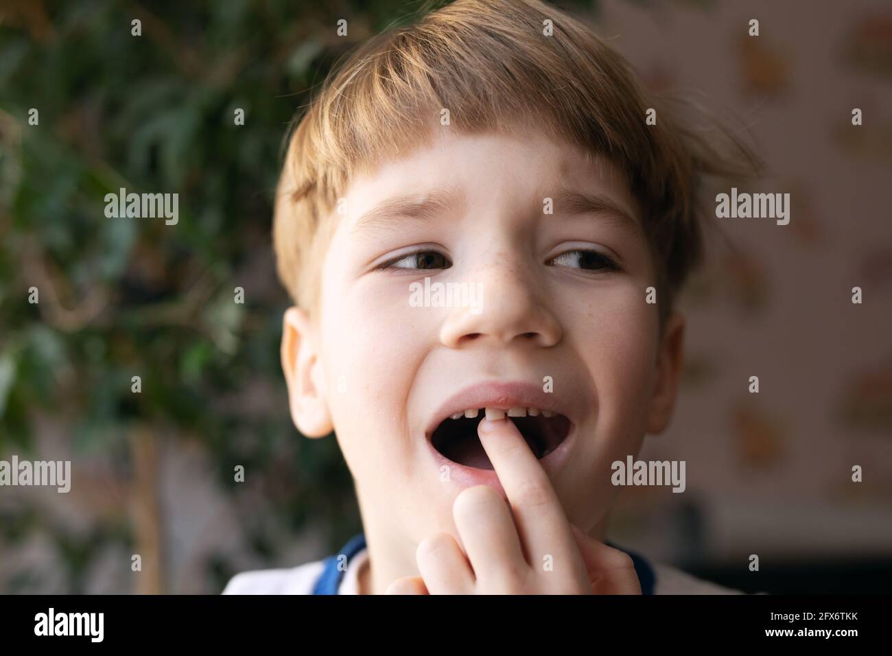 Portrait D Un Garcon Blond Effraye Montrant Une Dent De Bebe Branlante Dans Sa Bouche Sur Fond Flou De L Appartement Des Maux De Dents Ou Une Nouvelle Dent Pousse Photo Stock Alamy