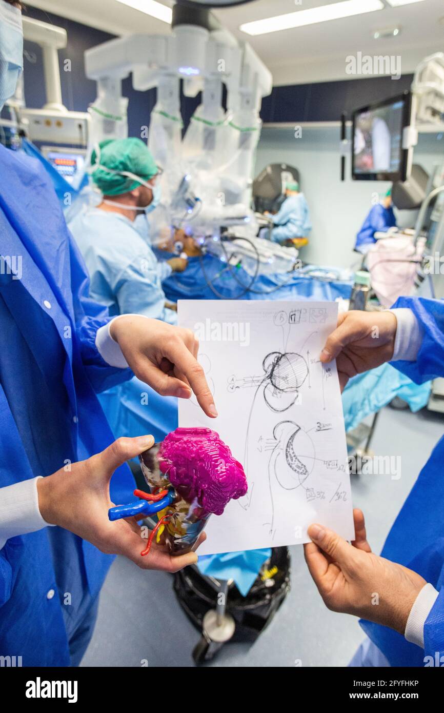 impression 3d d'un rein. La chirurgie rénale conservatrice robotique guidée par l'image assistée par la modélisation 3D, cette modélisation 3D du rein avec sa tumeur située i Banque D'Images