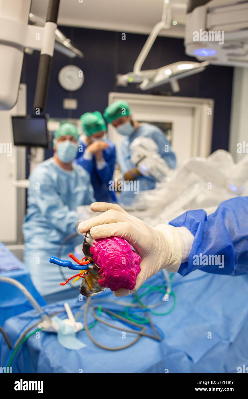 impression 3d d'un rein. La chirurgie rénale conservatrice robotique guidée par l'image assistée par la modélisation 3D, cette modélisation 3D du rein avec sa tumeur située i Banque D'Images
