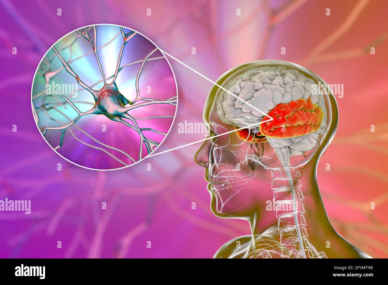 Lobe temporal humain et neurones, illustration Banque D'Images