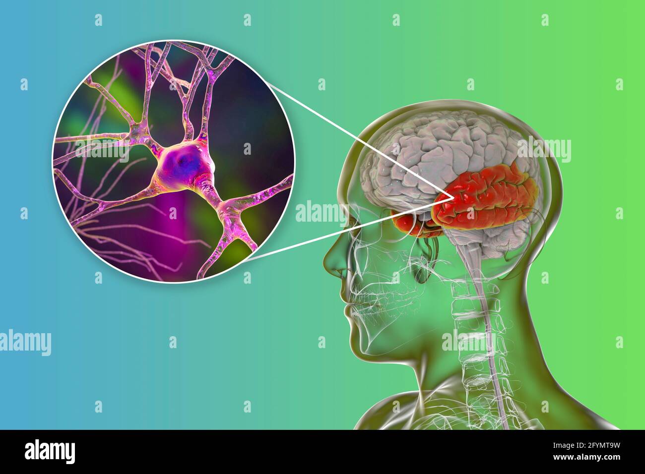 Lobe temporal humain et neurones, illustration Banque D'Images