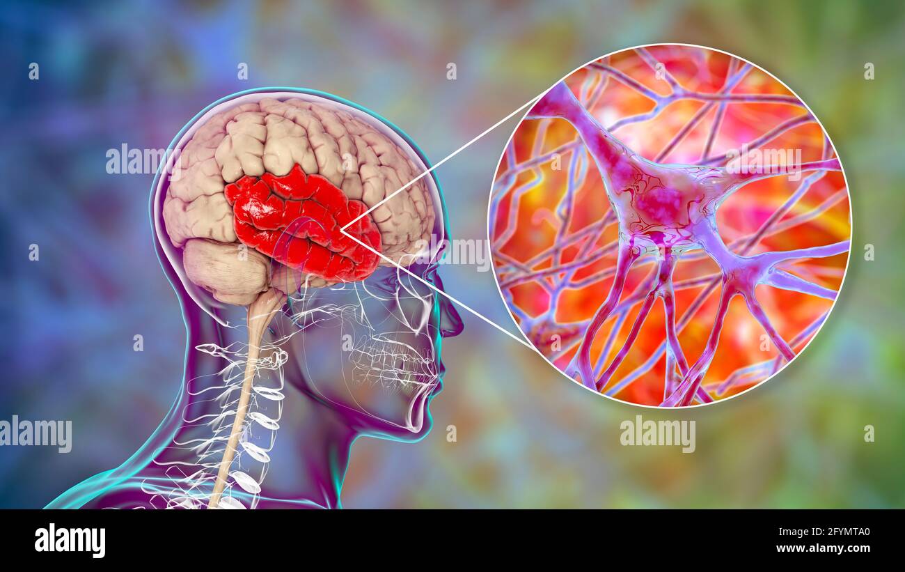 Lobe temporal humain et neurones, illustration Banque D'Images