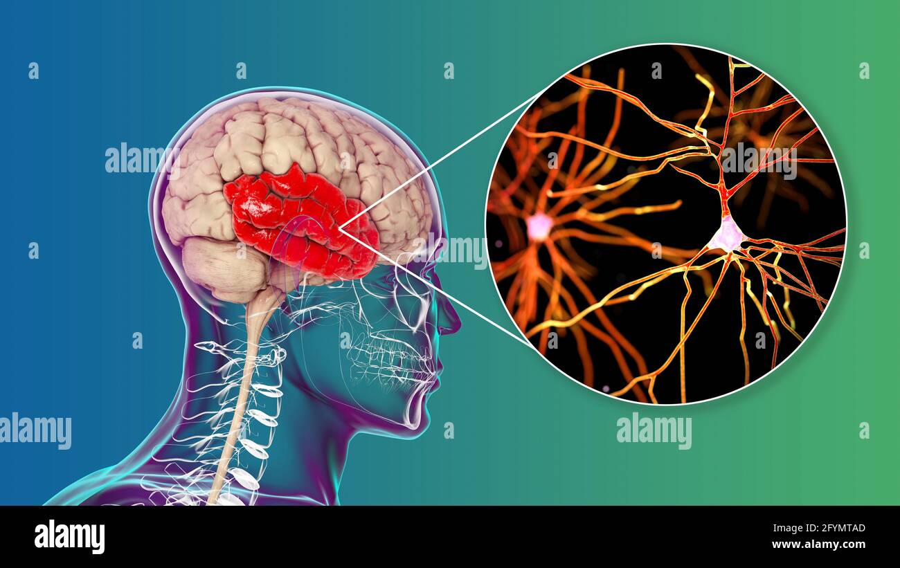 Lobe temporal humain et neurones, illustration Banque D'Images