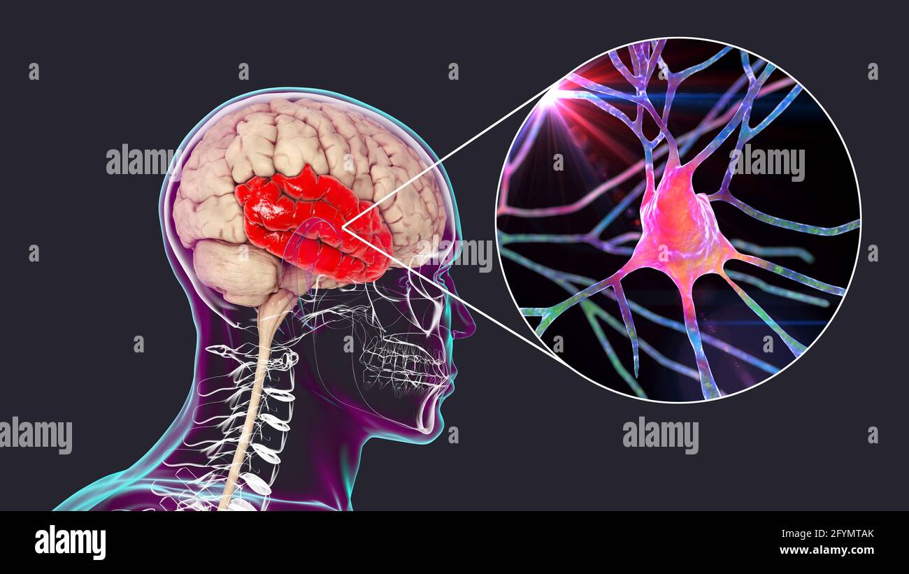 Lobe temporal humain et neurones, illustration Banque D'Images