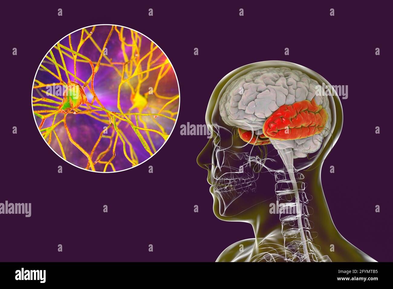Lobe temporal humain et neurones, illustration Banque D'Images
