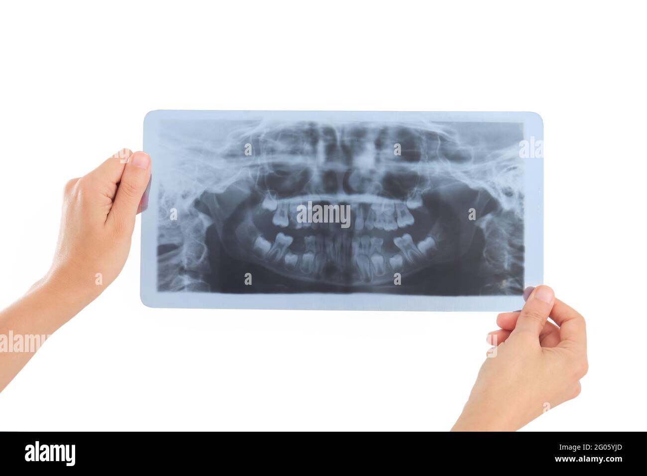 Mains tenant une radiographie dentaire d'un enfant Banque D'Images