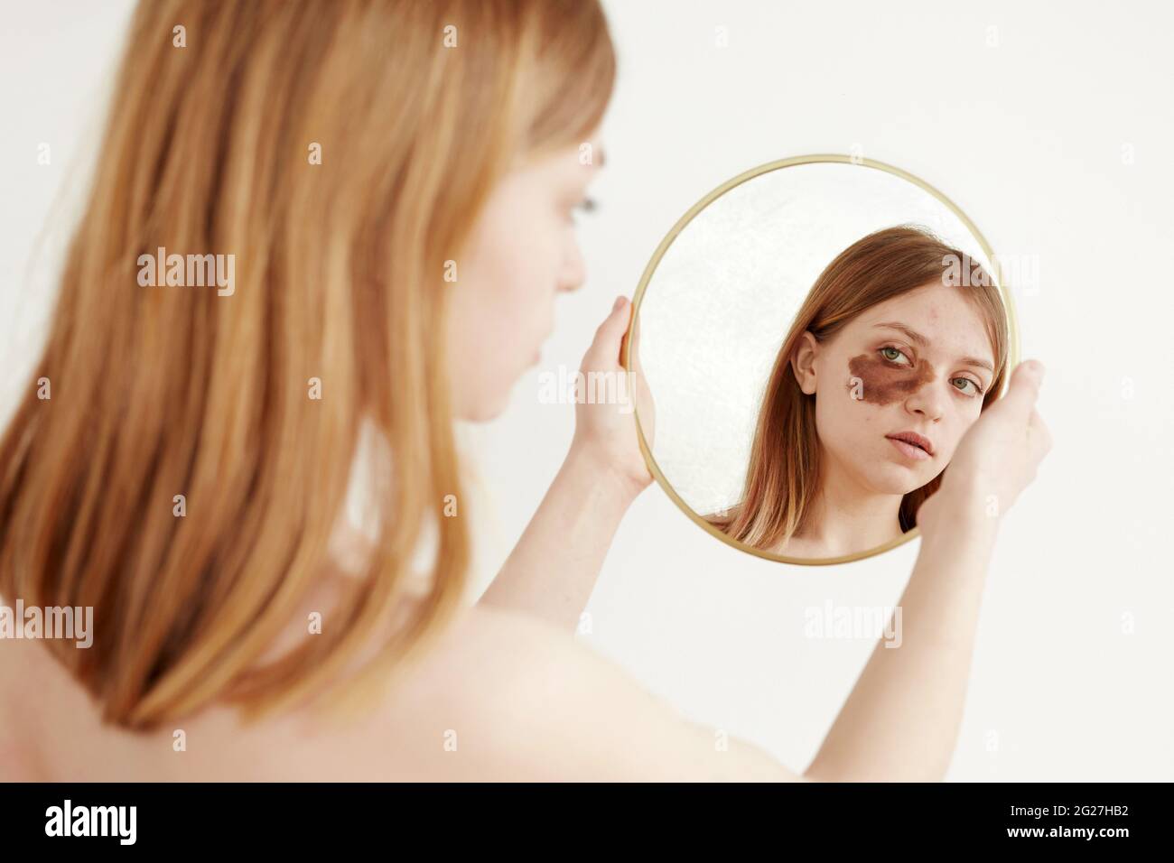 Jeune femme avec grand spot marron sur le visage sous l'œil regardant la réflexion miroir sur fond blanc Banque D'Images