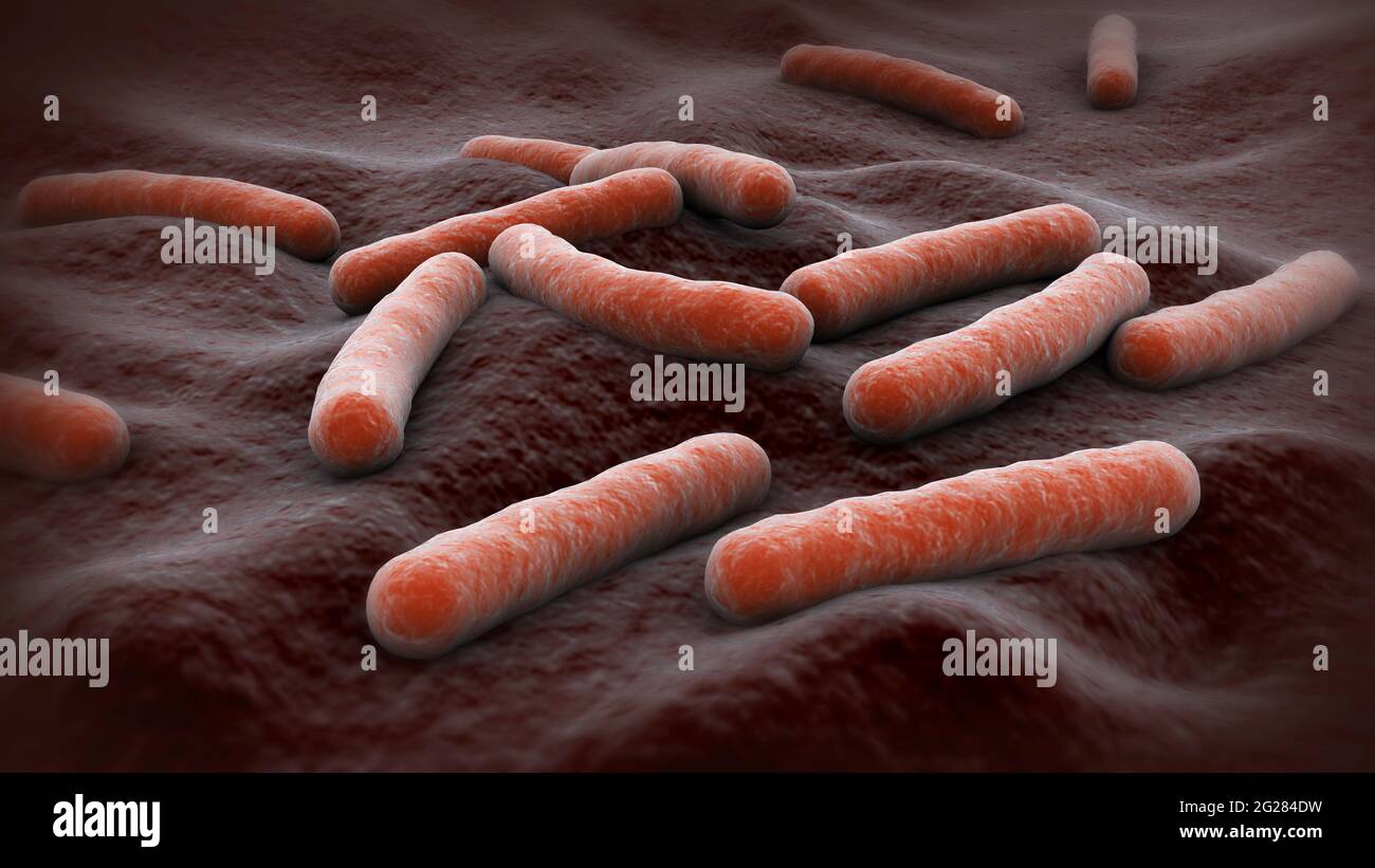 Illustration biomédicale de la tuberculose, une maladie infectieuse causée par des bactéries. Banque D'Images