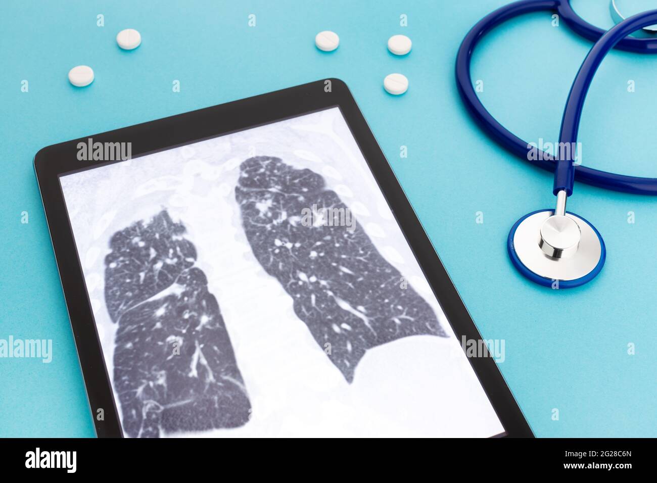 Tablette avec radiographie pulmonaire et stéthoscope et pilules sur fond bleu. Concept des maladies pulmonaires Banque D'Images