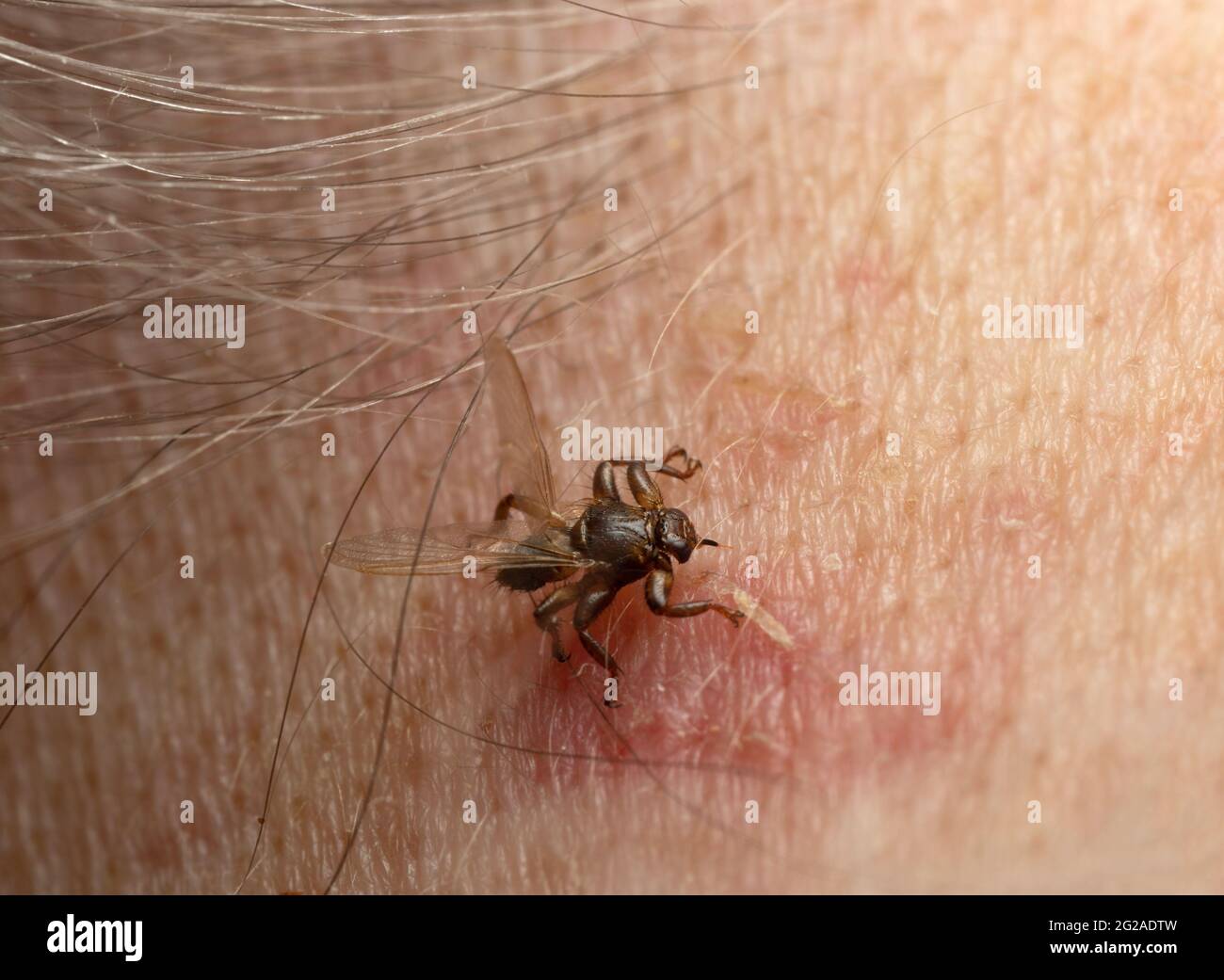 Mouche de cerf, Lipoptena cervi piquant sur le cou humain, cet insecte est actif pendant l'automne et peut mordre l'homme dans de rares occasions Banque D'Images