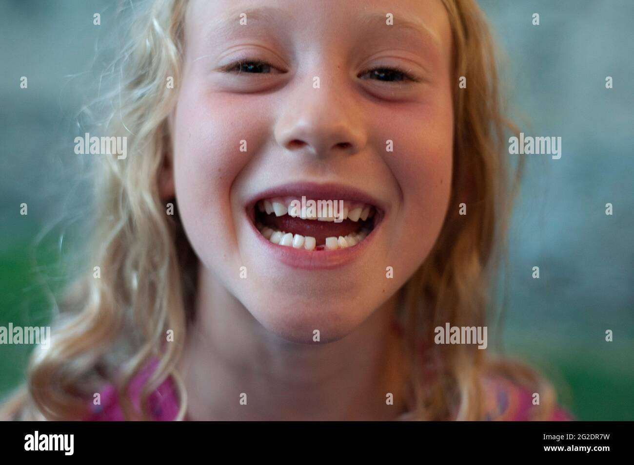 Une jeune fille montre fièrement sa bouche et l'écart dans ses dents où sa première dent à tomber était. Banque D'Images