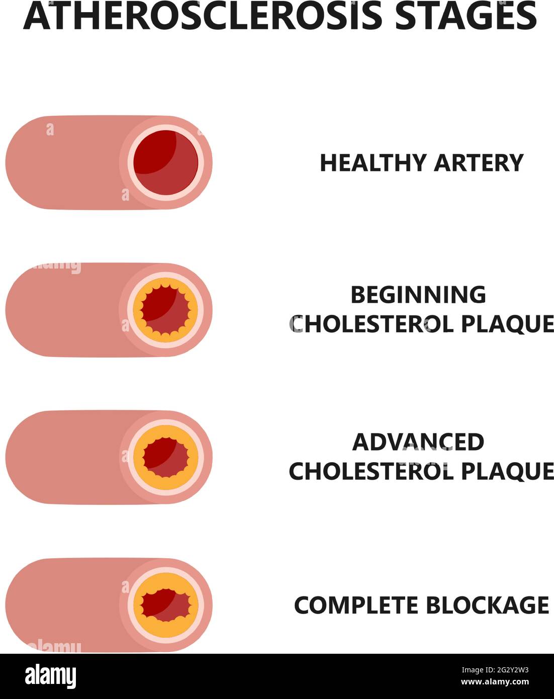 Blutgefass bildung Banque de photographies et d’images à haute résolution Alamy