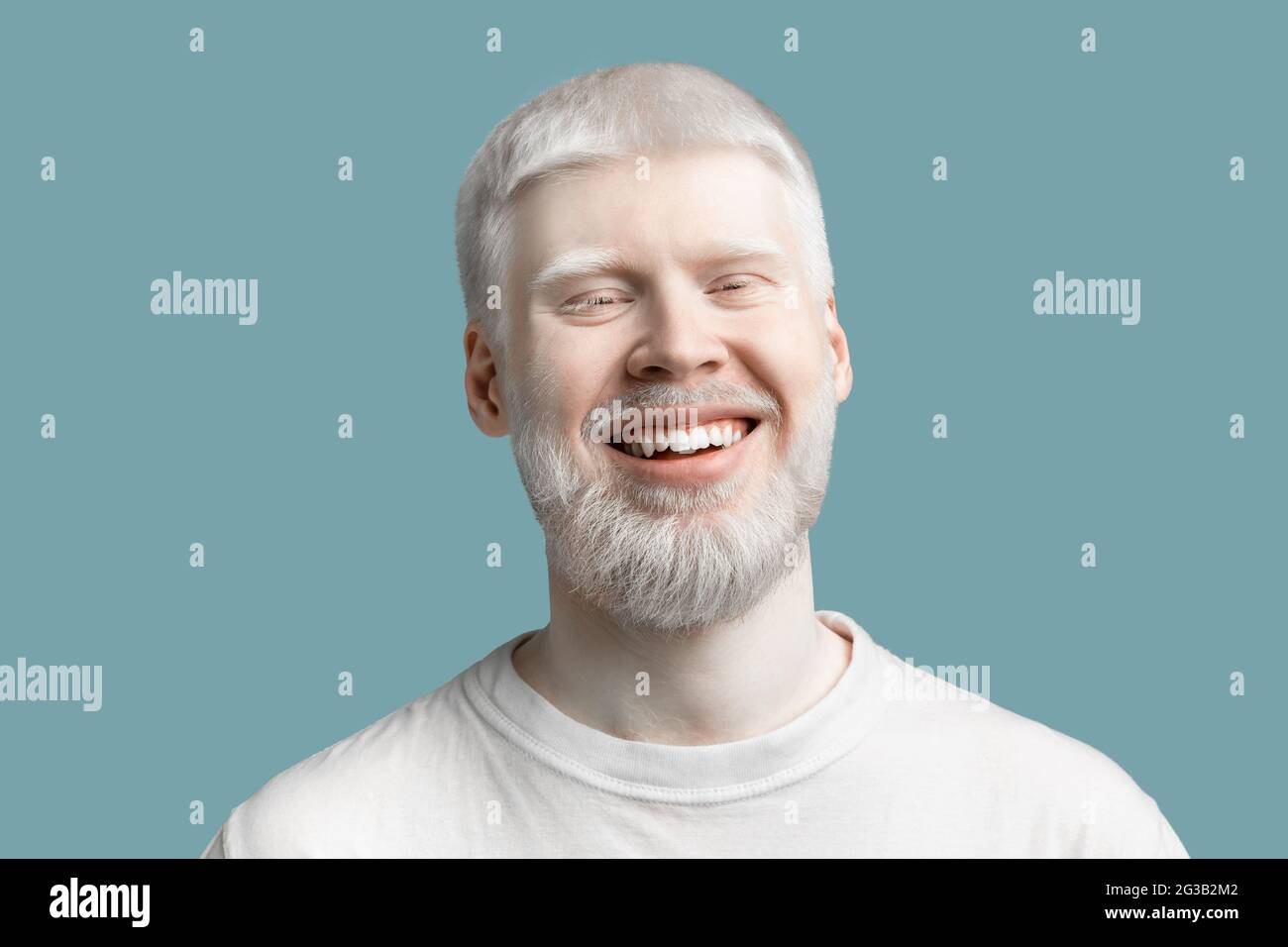Portrait d'un albinos à barbe heureux avec une peau pâle et des cheveux blancs portant un t-shirt, posant et souriant à l'appareil photo sur fond turquoise studio. Abnor Banque D'Images