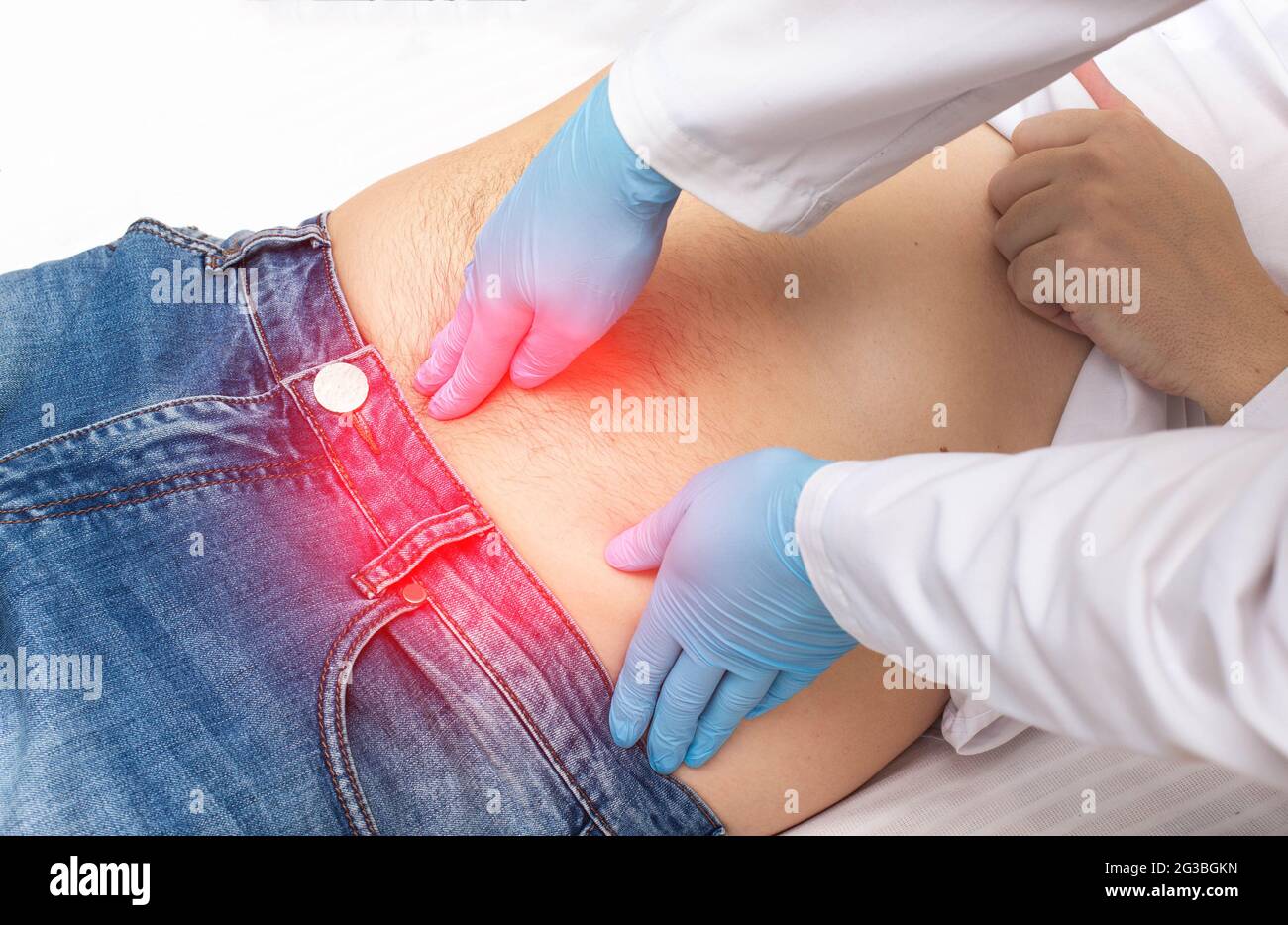 Le chirurgien effectue un examen du doigt d'un patient qui a de la douleur autour du nombril. Concept de la hernie ombilicale, élimination de la hernie ombilicale, clos Banque D'Images