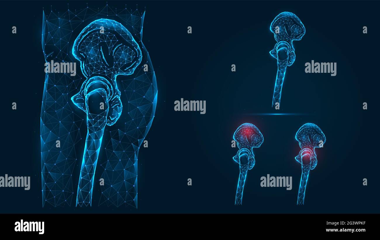 Illustration polygonale des os du bassin et de la hanche humains vue latérale. Maladie, douleur et inflammation du bassin et de l'articulation de la hanche. Faible Banque D'Images
