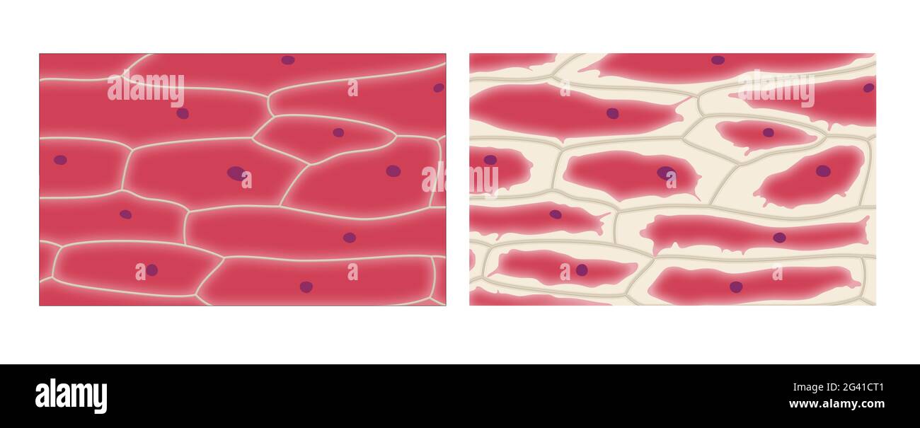 Plasmolyse dans les cellules épidermiques de l'oignon Banque D'Images