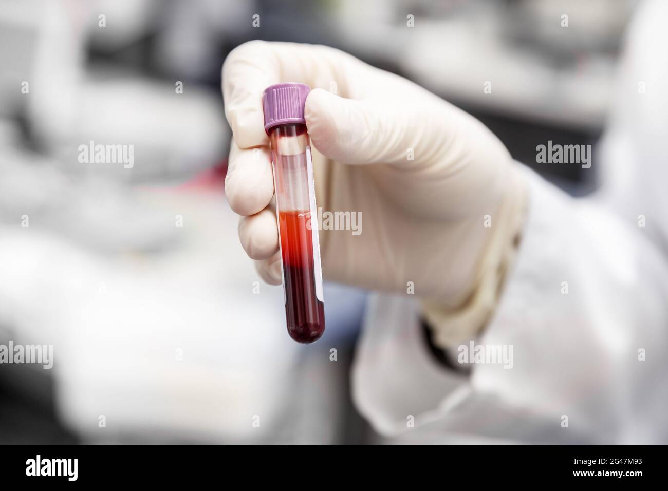 Main du travailleur médical dans un gant en caoutchouc tenant un tube de laboratoire avec un échantillon de sang. Concept médical de santé Banque D'Images