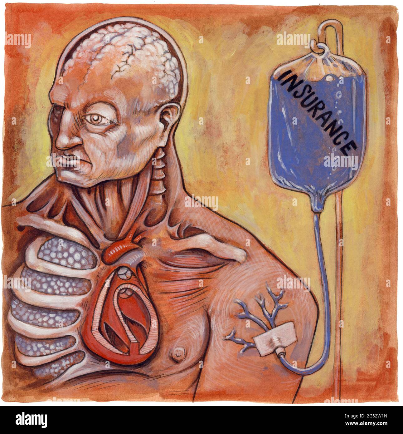 Concept art : corps de style illustration médicale recevant une assurance transfusionnelle étiquetée. Représenter les partenariats public-privé et le rôle du vaccin Covid Banque D'Images