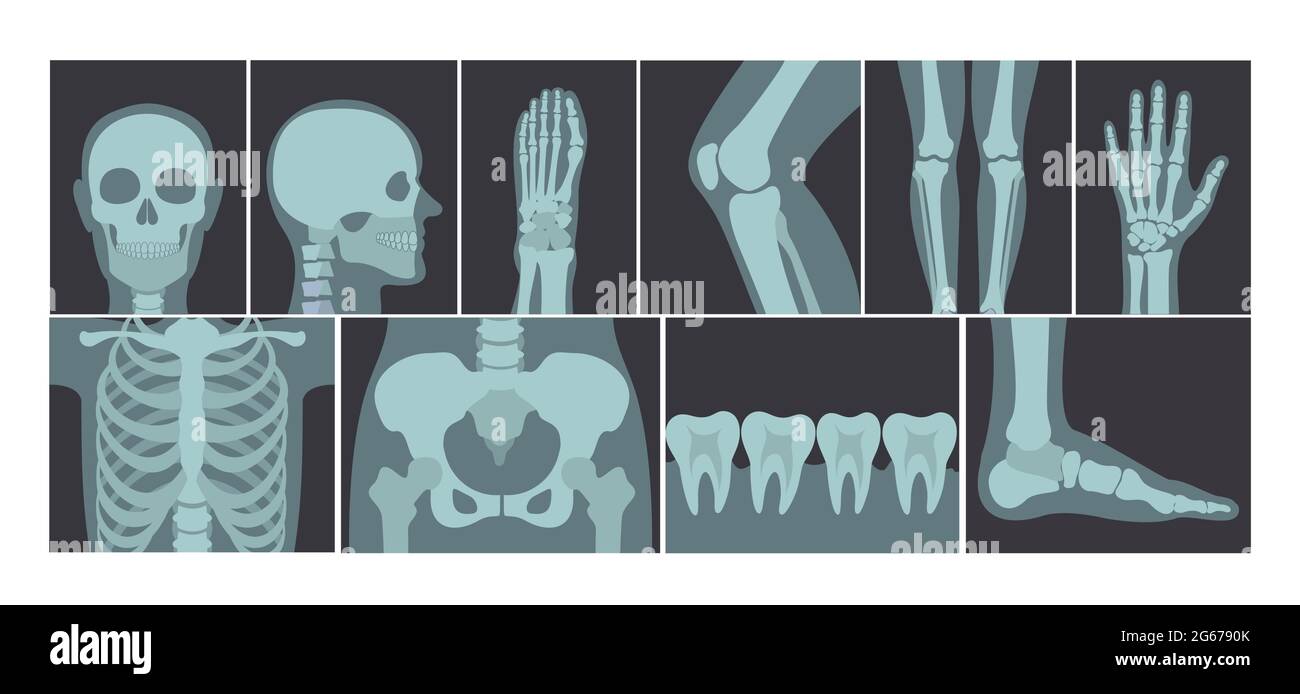Ensemble d'illustrations vectorielles de nombreux clichés de rayons X du corps humain, images radiographiques de la tête, des mains, des jambes et d'autres parties du corps sur fond blanc. Illustration de Vecteur