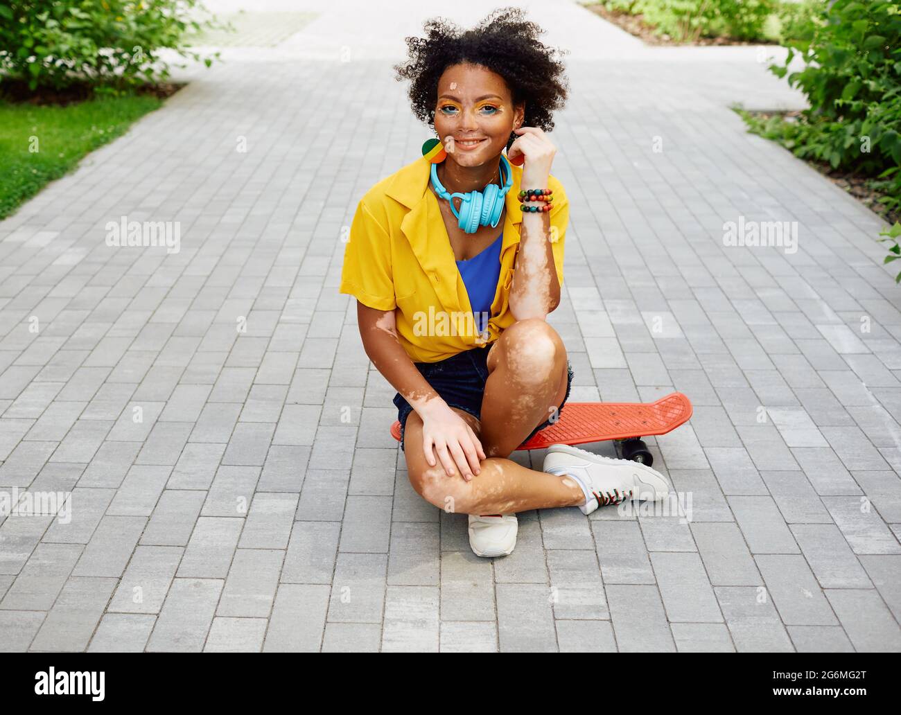 Adolescente positive avec vitiligo assis sur le skateboard rouge à l'extérieur dans le parc de la ville Banque D'Images